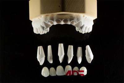 China Las carillas feldspáticas de porcelana dental para dientes en forma personalizada en venta