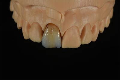 Cina Corone di zirconia a prezzi accessibili con colorazione personalizzata - Laboratorio dentale cinese in vendita