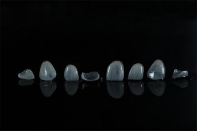 China E.max Dental Veneers from direct China dental lab à venda