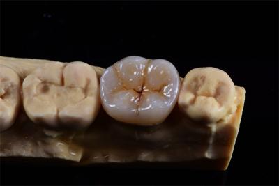 China Layered Zirconia Crown for Natural Aesthetics from China Dental Lab for sale