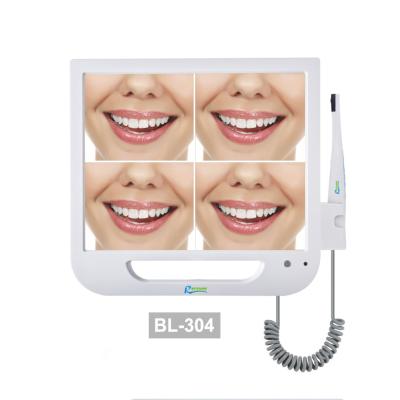 China High Quality Metal D70s Antar Technologi Intraoral Dental Camera For People for sale