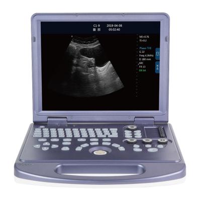 China Matal RB-Mu15 VET B/W High Level Portable Cheap Veterinary Ultrasound Scanner for sale