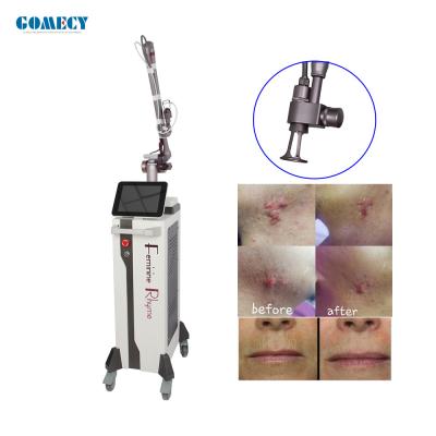 China Scar Removal Vaginal Tightening Co2 Fractional Laser Machine 40W for sale