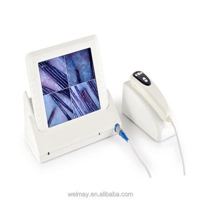 China New Acne Analysis Clinic Spa Salon Welmay Skin Analyzer Facial Scalp and Hair Skin Analyzer Machine for sale