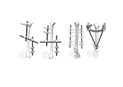 China Externo femoral Fixator del fragmento del sistema externo de la fijación del carbono/del acero inoxidable en venta