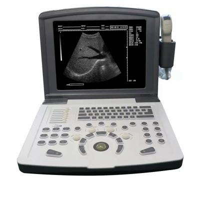 China Full Metal Ultrasound Equipment Digital Ultrasound Scanner Machine Convex Body Transvaginal for sale