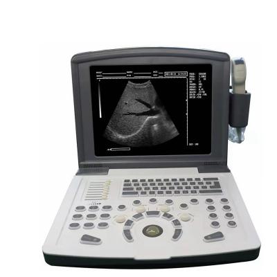 China Metal Pregnancy Ultrasound Equipment Portable Laptop Ultrasound Scanner Machine Price for sale