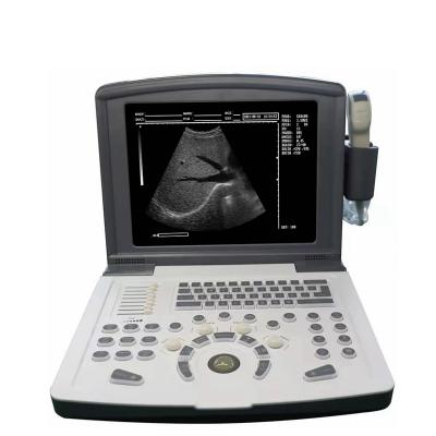 China Metal Image High Resolution Low Price Portable Ultrasound Scanner Machine for sale