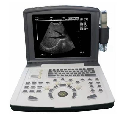 China Metal Medical Hospital B Mode Cheap Portable Ultrasound Scanner Machine for sale