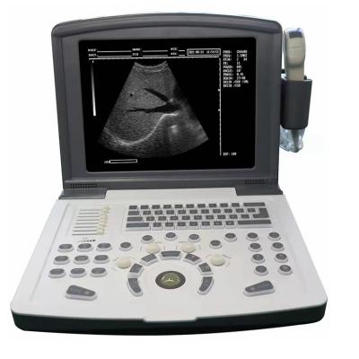 China Full Metal Premium Digital Laptop Ultrasound Scanner Machine for sale