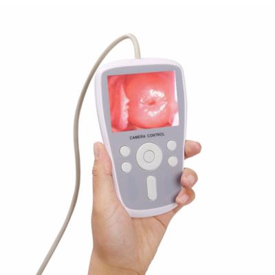 China Digital Plastic Handheld Electronic Colposcope Camera High Resolution Imaging For Gynecology for sale