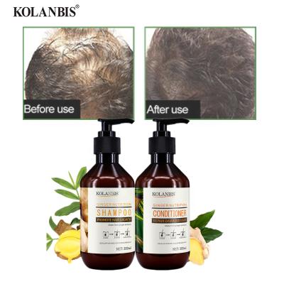 China Wholesale KOLANBIS Factory Loss Prevention Zingiber Zerumbet Extract Shampoo and Conditioner Set Women Hair Nourisher Hair Falling Outlet Treatment for sale