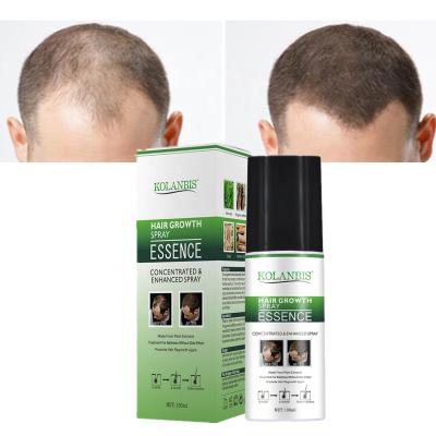 China Wholesale KOLANBIS Hair Loss Prevention Regrowth Serum Naturally Spray Anti Hair Fall Treatment For Hair Growth for sale