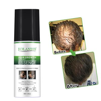 China KOLANBIS Hair Loss Prevention Herbs Oils Hair Growth For Women Chinese Hair Growth Liquid Serum for sale