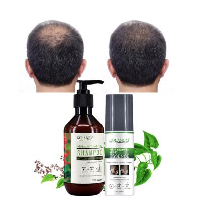 China Increase Quality Anti Hair Follicle Thickening Hair Shampoo Hair Loss Spray Hair Treatment Set Private Label for sale