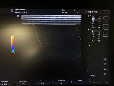 China GE VividE Original Linear Ultrasound Probe 9L-RS , GE Ultrasound Transducers 3.3-10.0 Mhz for sale