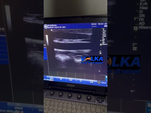 original ge ultrasound equipment portable ultrasound machine