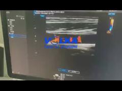 Samsung Medison HS60 Original Ultrasound Sensor LA4-18B Linear Probe