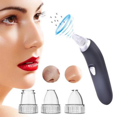 China Black Head Removal Facial Blackhead Remover Deep Cleansing, Pore Remover Blackhead Vacuum Remover for sale