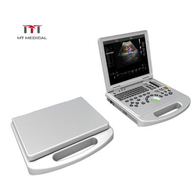 China High Configuration 3D 4D Color Laptop Hospital Doppler Portable Cardiac Ultrasound Machine en venta