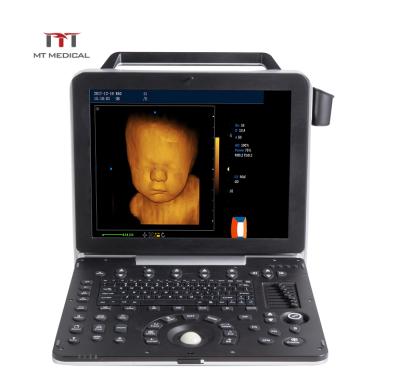 China Portable Metal Equipment Ultrasonic Laptop Echo Color Doppler 4D Cardiac Ultrasound Machine en venta