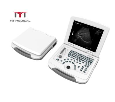 China High Specification Portable Metal Laptop Ultrasound Scanner Machine en venta