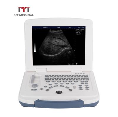 China Metal MT Laptop Medical Hot Selling Portable Ultrasound Black And White Machine for sale