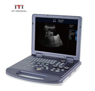 China Metal Ultrasound Manufacturing Clear Performance Portable Laptop Ultrasound Scanner Machine Price for sale