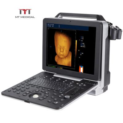 China Metal Clear Imaging Portable Digital 3D/4D Color Doppler Echocardiography Cardiac Ultrasound Machine en venta