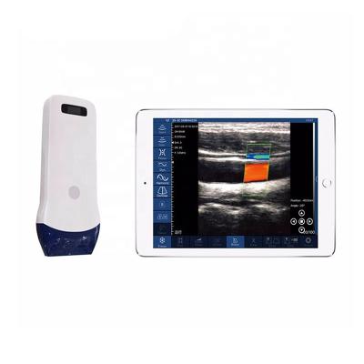 China Steel Portable Wireless Color Doppler Ultrasound Linear Probe / Machine / Equipments à venda