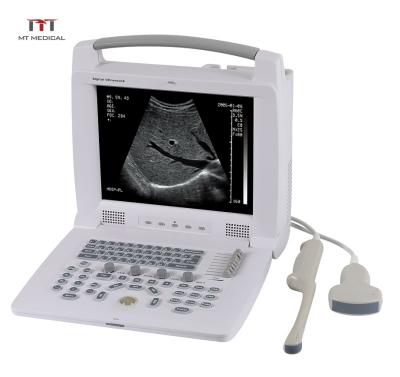 China Metal MT China Digital Medical Portable Veterinary Ultrasound Price for sale