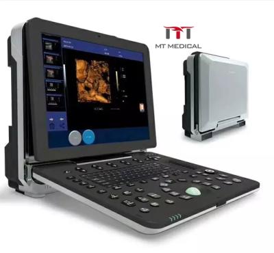 中国 Metal Ten 128 Probe Elements Optional Portable CW 3D/4D Color Doppler Ultrasound Machine 販売のため