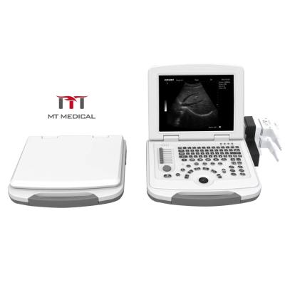 China Portable ABS Digital Laptop Color Doppler Ultrasound Machine en venta