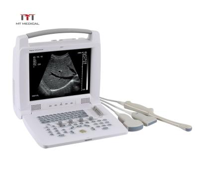 China Metal MT Ultrasound Equipment Laptop Veterinarian Portable Veterinary Ultrasound Physiotherapy Equipment Te koop