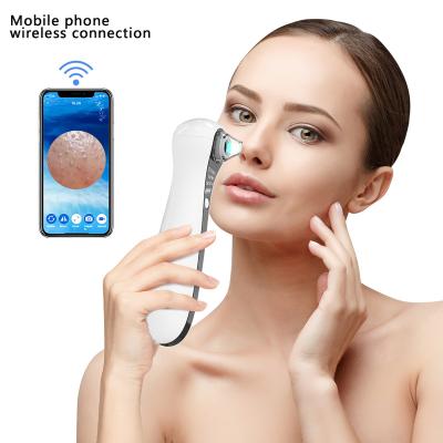 China Acne Treatment Beauty Equipment Blackhead Removal Device Pore Vacuum Remove Blackhead Blackhead Remover With Camera for sale