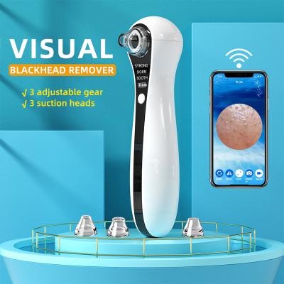 China Acne Treatment Skin Care Blackhead Remover Vacuum Beauty Machine Camera Visual Electric Pore Remover for sale