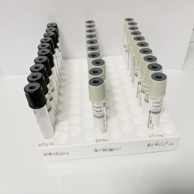 China Sterile Red Top Blood Collection Tubes Clot Activator Tube CE And ISO Approved for sale