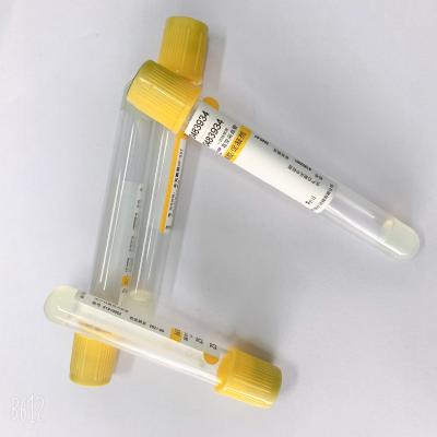 China Serum Separating Blood Collection Tube Vacuum Gel Tube With Clot Activator for sale