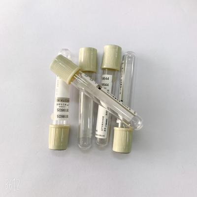 China EDTA Na 2 Glucose Blood Tube  Phlebotomy Color Coded  For Sugar Hemolysis for sale