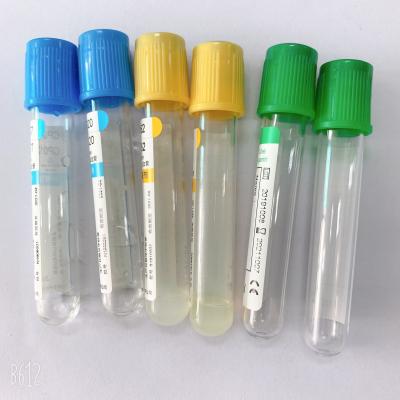 China Esr Citrate Blood Collecting Tube 8*120mm Micro SST Phlebotomy Tube for sale