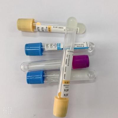 China Customized Blood Sample Bottles CE  ISO 13485 Certificated Serum Gel Blood Test for sale