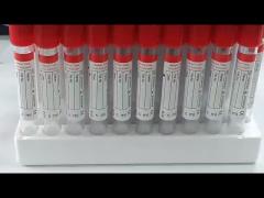 Hospital Medical Plain Blood Collection Tube With Red Top