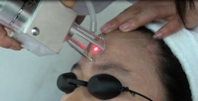 China Máquina do laser do rejuvenescimento da pele do CO2 do tubo do RF, máquina dos cuidados com a pele do laser à venda