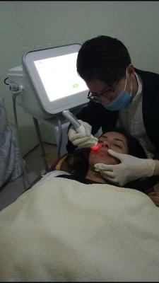 China Laser Face lifting Microdermabrasions-Schälmaschine-650nm entzündungshemmend zu verkaufen