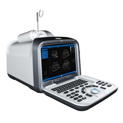 China Cheapest Multifunctional Black White Clinical Abdomen Ultrasound Machine for sale