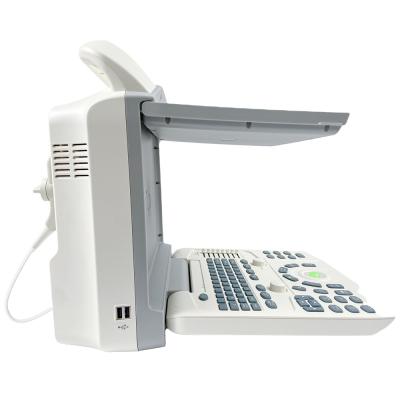 China Qincare-i50 Portable Metal Ultrasound Machine Medical Treatment B/w Ultrasound Machine for sale