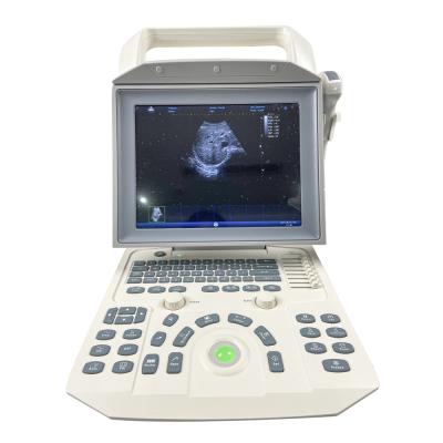 China Medical Portable Abdomen Full B/W Ultrasound Digital Medical Instruments for sale