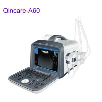 China Cheap Black And White Abdomen Ultrasound Machine Price Hot Selling In Nigeria for sale