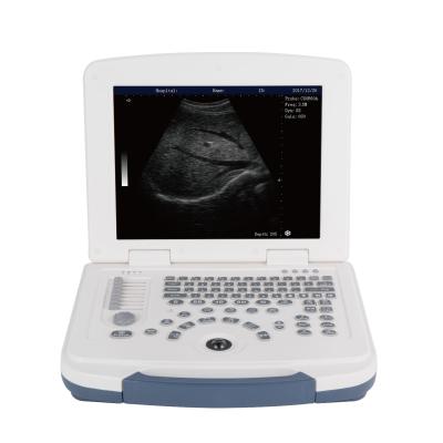 China Portable Black And White Metal Ultrasound Machine Laptop Ultrasound Machine for sale