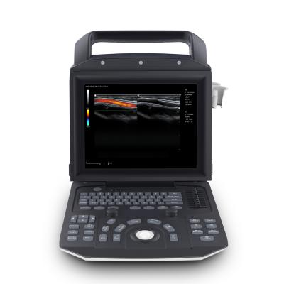 China Portable Metal Color Doppler System Ultrasound Machine 4d Color Doppler Ultrasound Cardiac Machine for sale